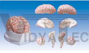 The model of brain and cerebral arteries